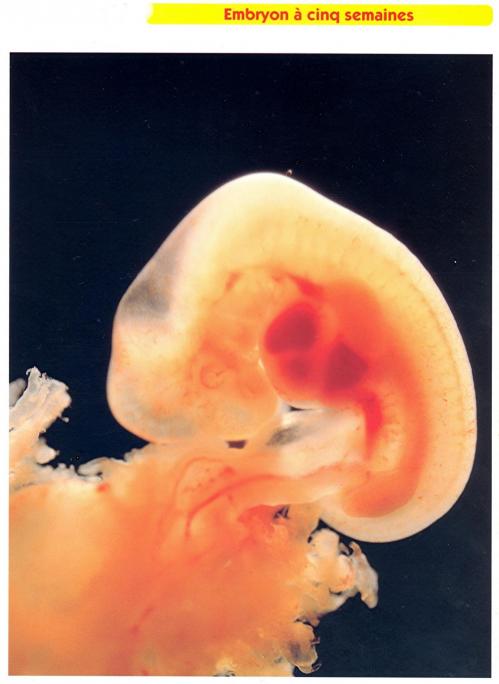 Embryon